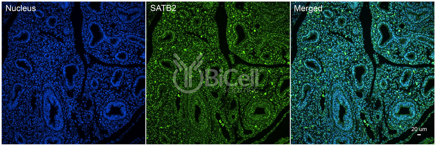 SATB2 Antibody - Western Blot Validated