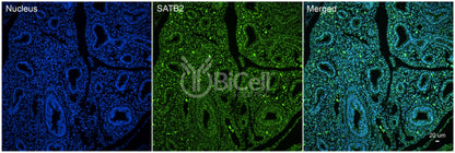 SATB2 Antibody - Western Blot Validated
