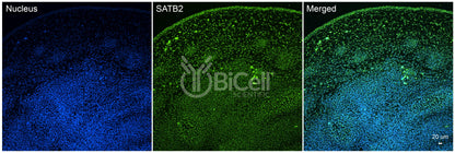 SATB2 Antibody - Western Blot Validated