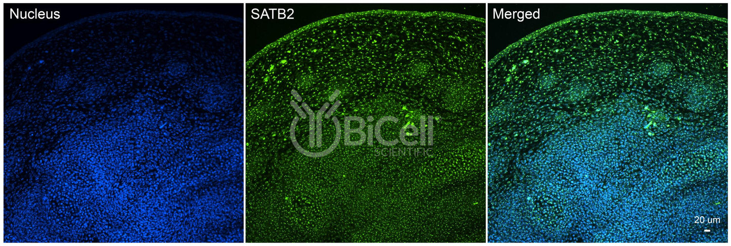 SATB2 Antibody - FFPE Validated