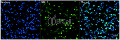 SALL1 Antibody - Western Blot Validated