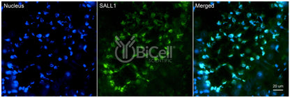 SALL1 Antibody - FFPE Validated