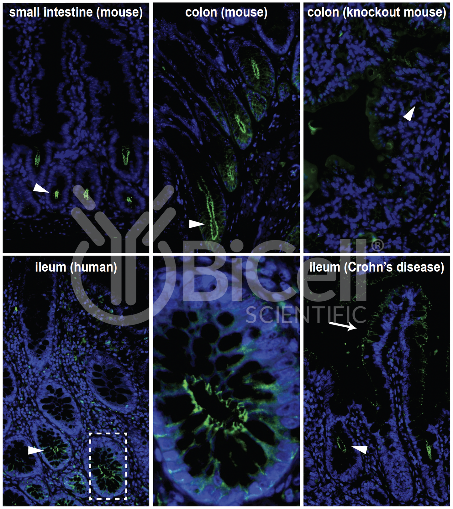 Claudin-2 (CLDN2) Monoclonal Antibody (E5 Clone)