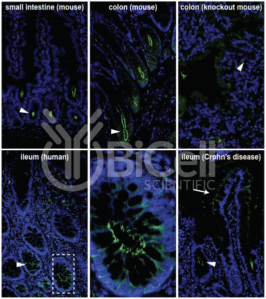 Claudin-2 (CLDN2) Monoclonal Antibody (E5 Clone)