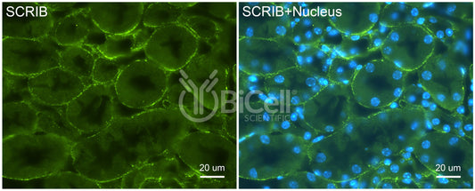 SCRIB (Scribble or SCRIBL) Antibody