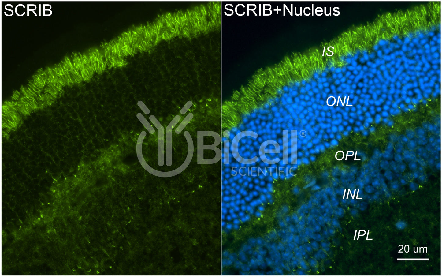 SCRIB (Scribble or SCRIBL) Antibody - FFPE Validated