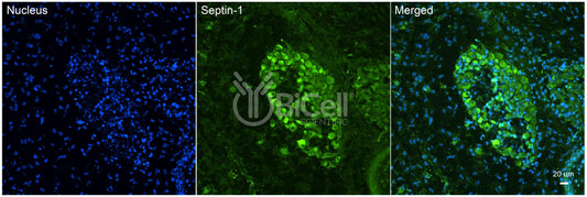 SEPTIN1 (SEPT1) Antibody - FFPE Validated