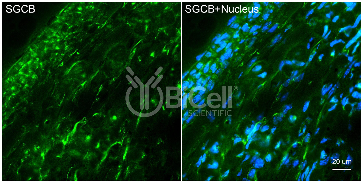 Sarcoglycan Beta (SGCB) Antibody