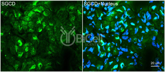 Sarcoglycan Delta (SGCD) Antibody