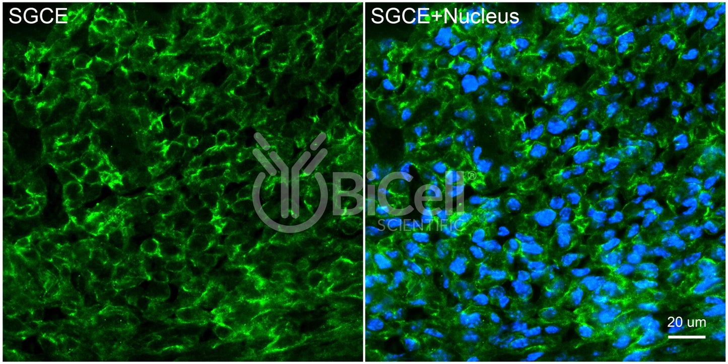 Sarcoglycan Epsilon (SGCE) Antibody