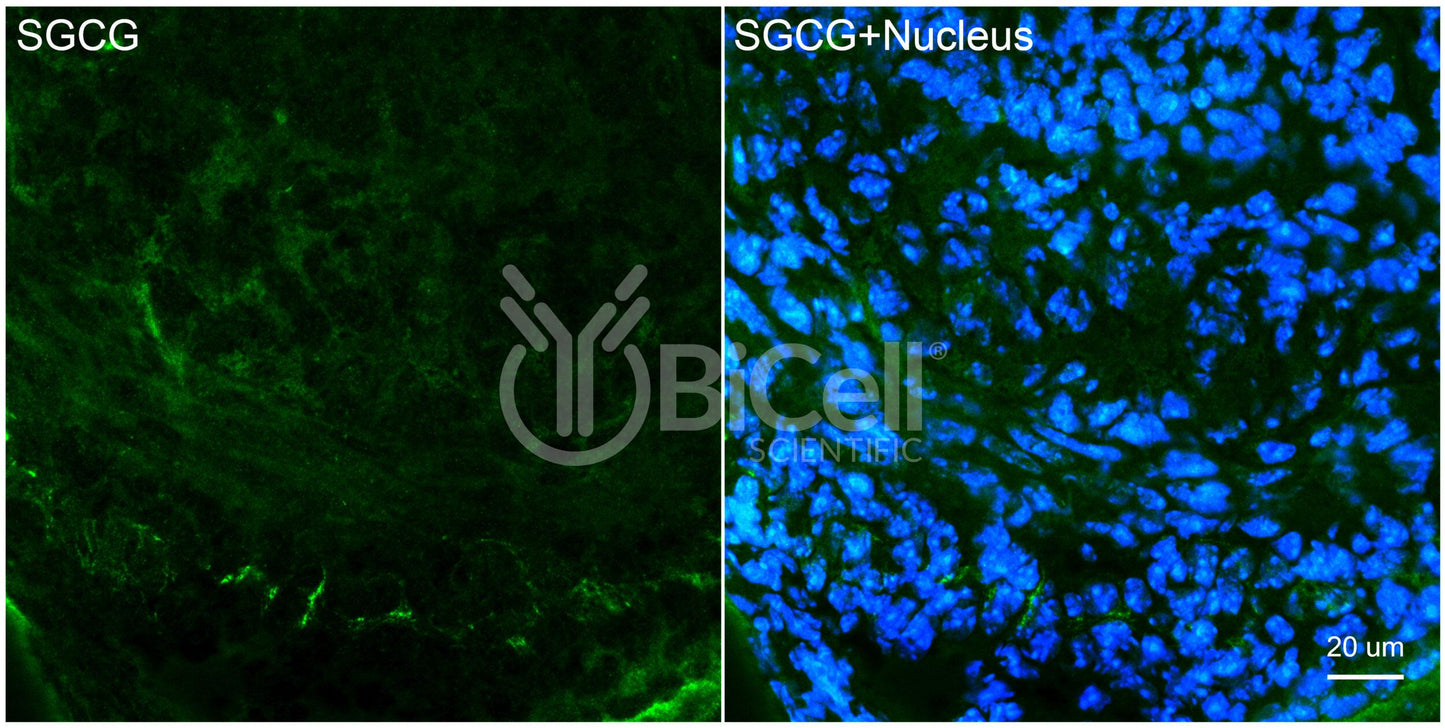 Sarcoglycan Gamma (SGCG) Antibody - Western Blot Validated