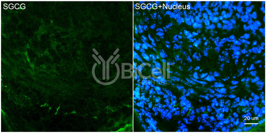 Sarcoglycan Gamma (SGCG) Antibody - FFPE Validated