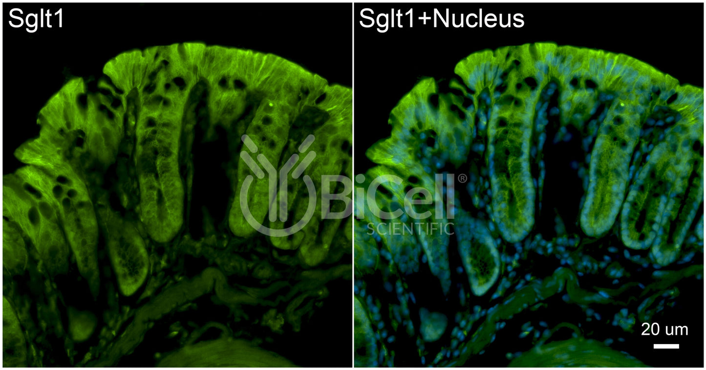 SGLT1 (Slc5a1) Antibody