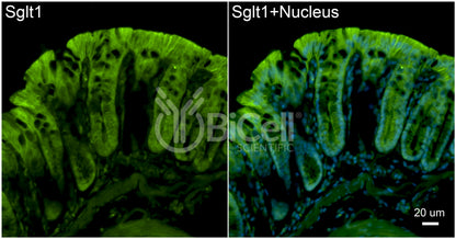 SGLT1 (Slc5a1) Antibody - FFPE Validated