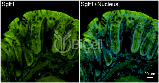 SGLT1 (Slc5a1) Antibody - FFPE Validated