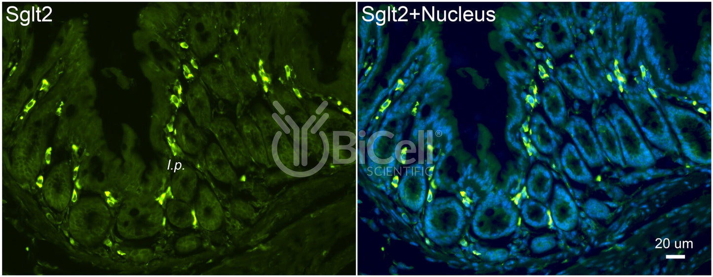 SGLT2 (Slc5a2) Antibody