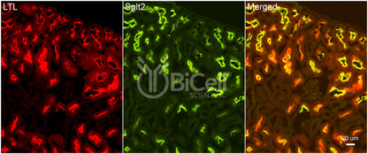 SGLT2 (Slc5a2) Antibody - Western Blot Validated