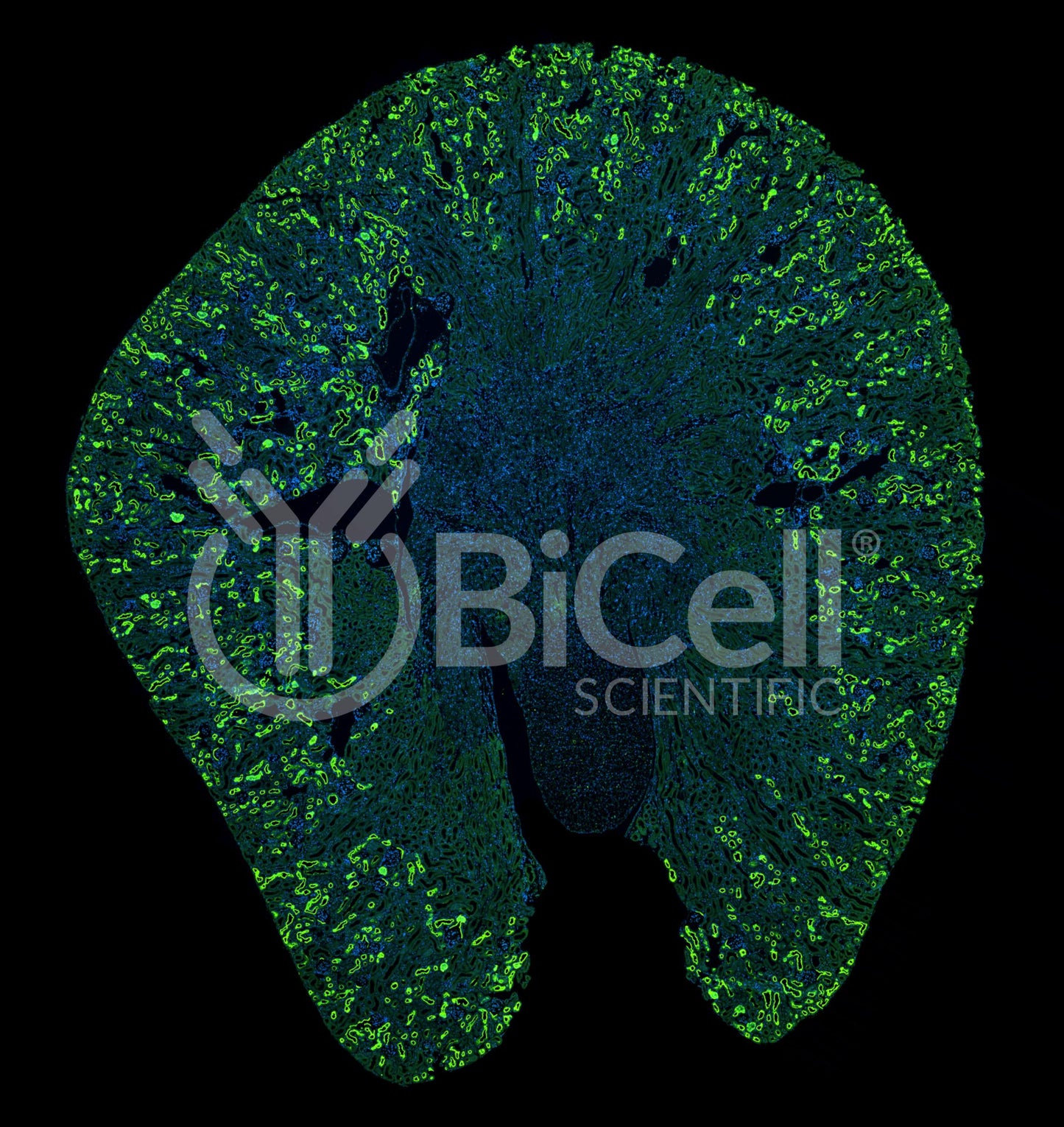 SGLT2 (Slc5a2) Antibody