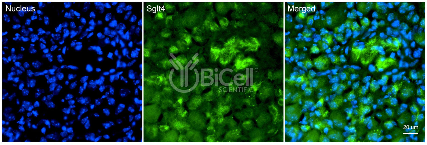 SGLT4 (Slc5a9) Antibody - FFPE Validated