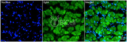 SGLT4 (Slc5a9) Antibody - Western Blot Validated