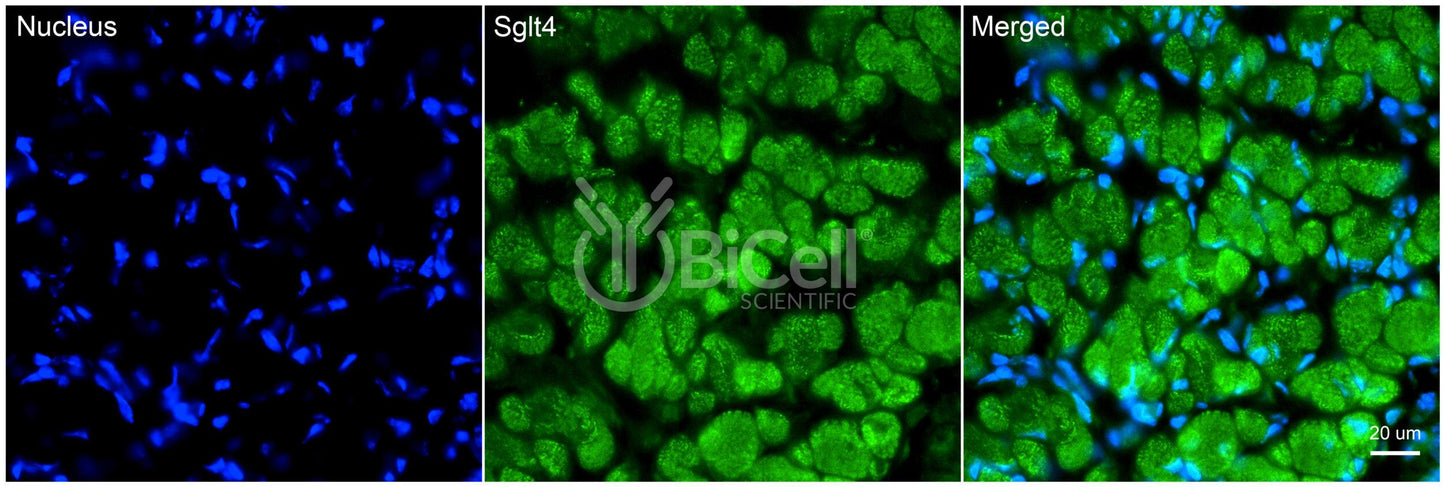 SGLT4 (Slc5a9) Antibody - FFPE Validated