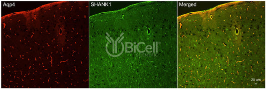 SHANK1 (Synamon) Antibody - Western Blot Validated