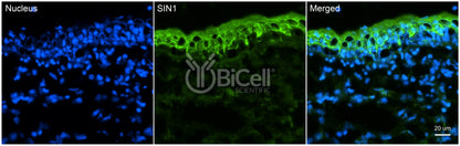 MAPKAP1 (SIN1) Antibody