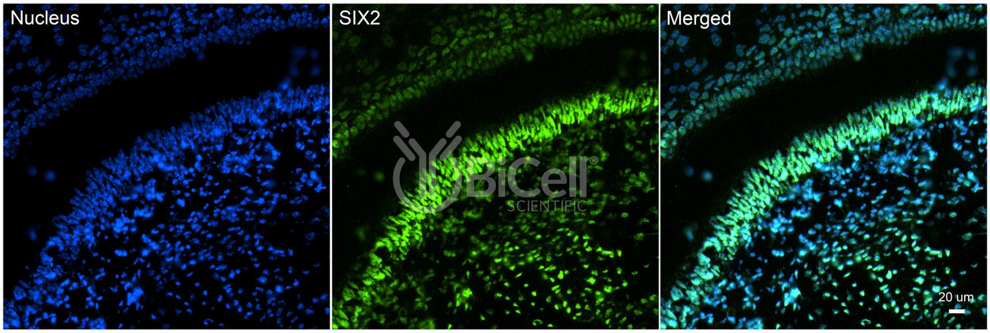 SIX2 Antibody