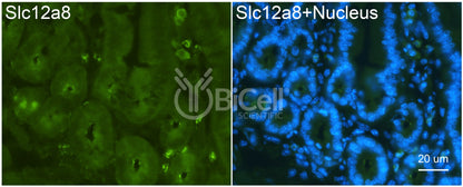 SLC12A8 (CCC9) Antibody - Western Blot Validated
