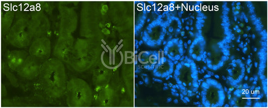 SLC12A8 (CCC9) Antibody - Western Blot Validated