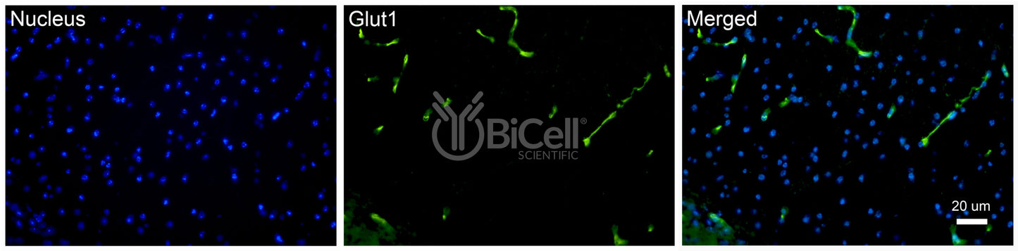 GLUT1 (SLC2A1) Antibody - Western Blot Validated
