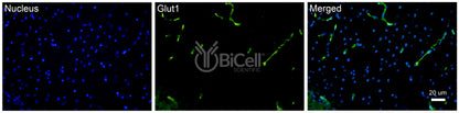 GLUT1 (SLC2A1) Antibody - FFPE Validated