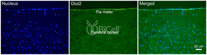 GLUT2 (SLC2A2) Antibody - Western Blot Validated