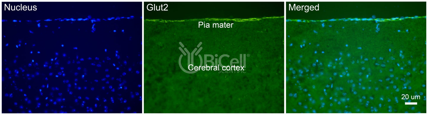 GLUT2 (SLC2A2) Antibody