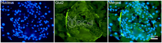 GLUT2 (SLC2A2) Antibody - FFPE Validated