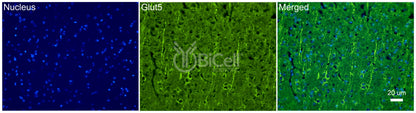 GLUT5 (SLC2A5) Antibody