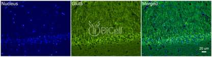 GLUT5 (SLC2A5) Antibody - FFPE Validated