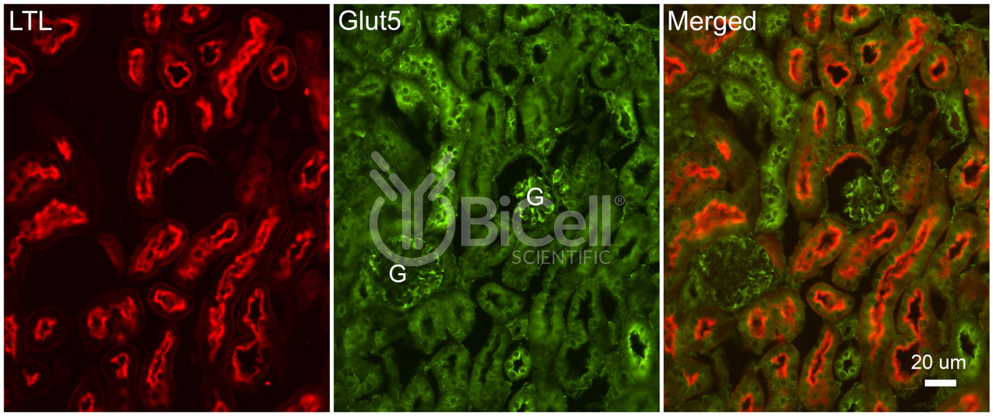 GLUT5 (SLC2A5) Antibody