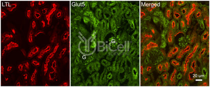GLUT5 (SLC2A5) Antibody