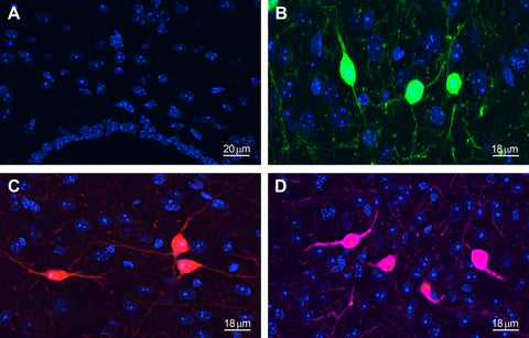 Slide Mount with DAPI