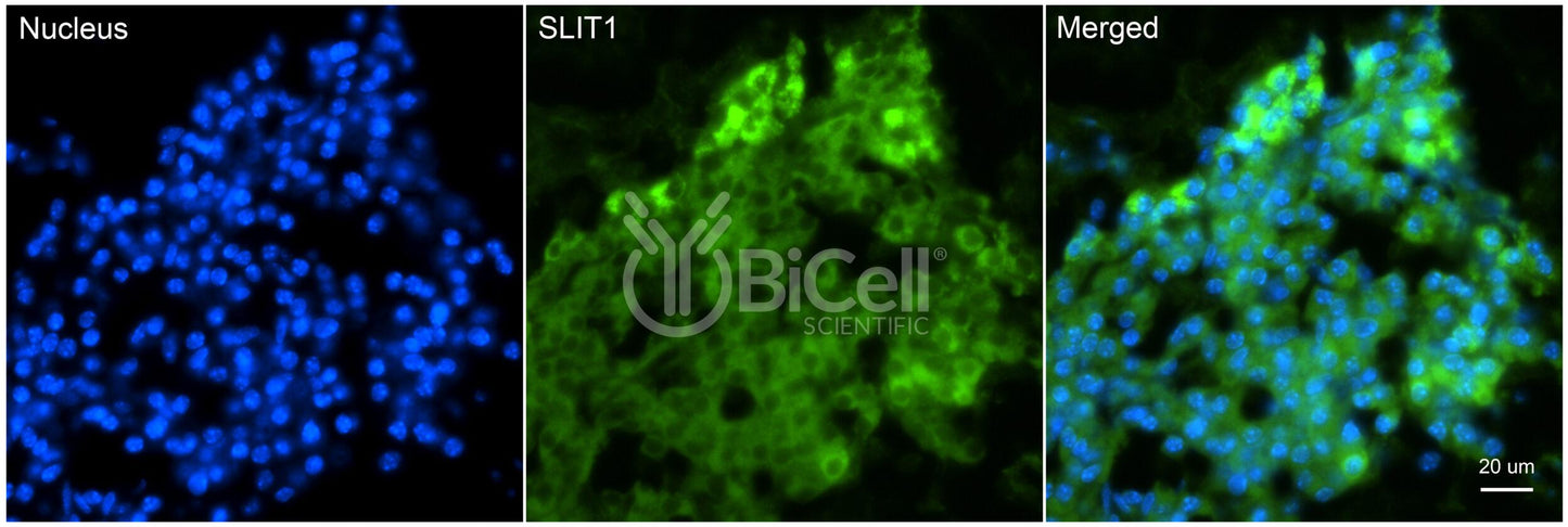 SLIT1 Antibody - FFPE Validated