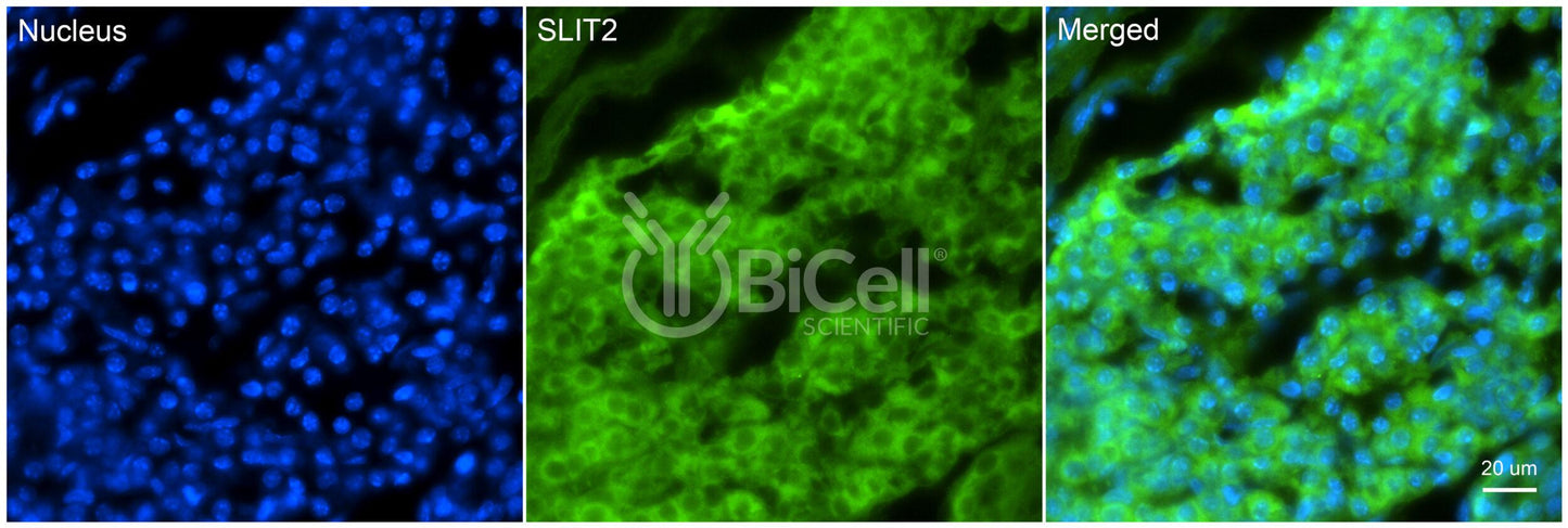 SLIT2 Antibody