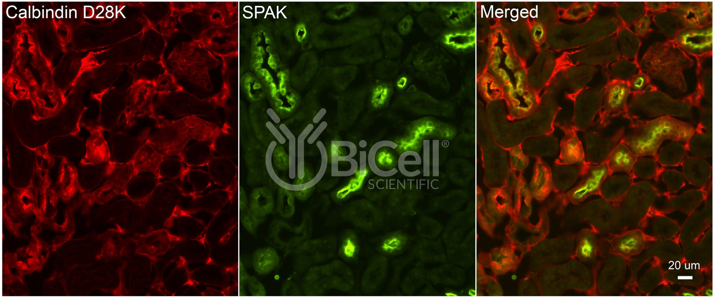 STK39 (SPAK) Antibody - FFPE Validated