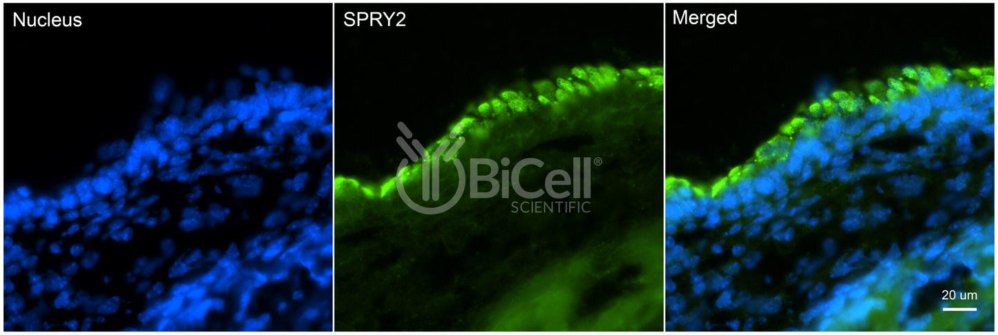 SPRY2 Antibody - Western Blot Validated