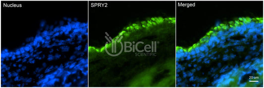 SPRY2 Antibody - FFPE Validated