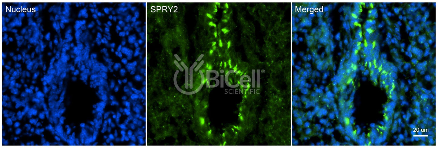 SPRY2 Antibody - Western Blot Validated