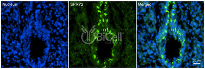 SPRY2 Antibody - FFPE Validated