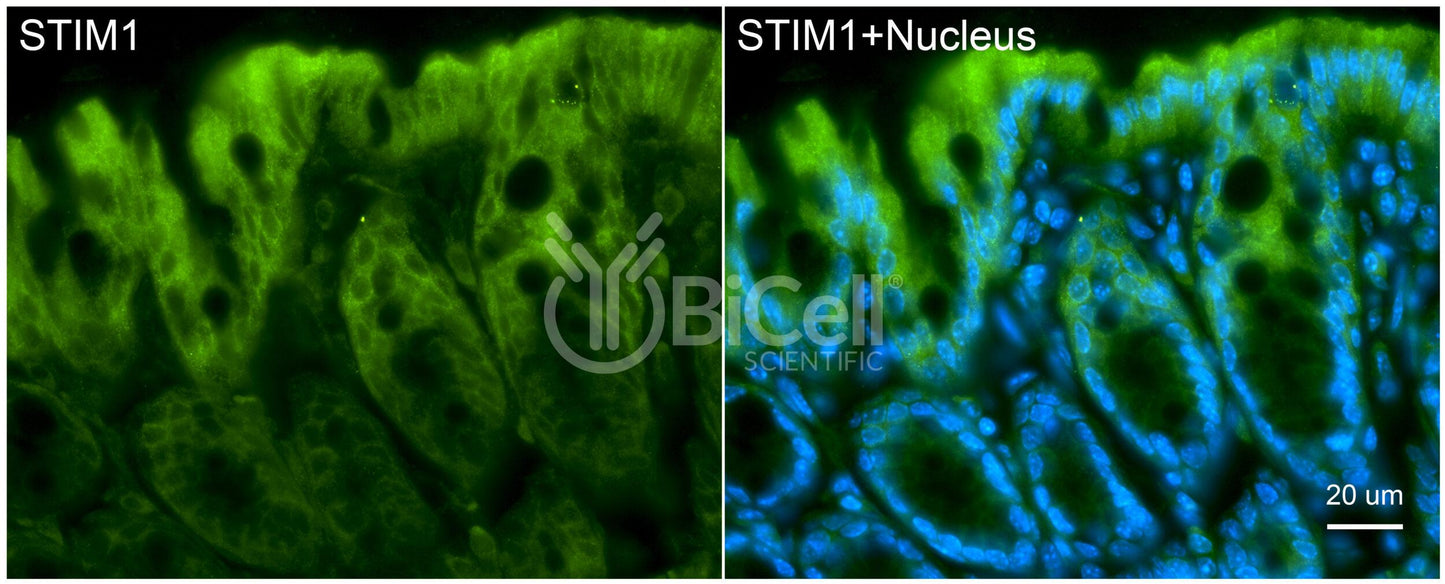 STIM1 (TAM1) Antibody - FFPE Validated