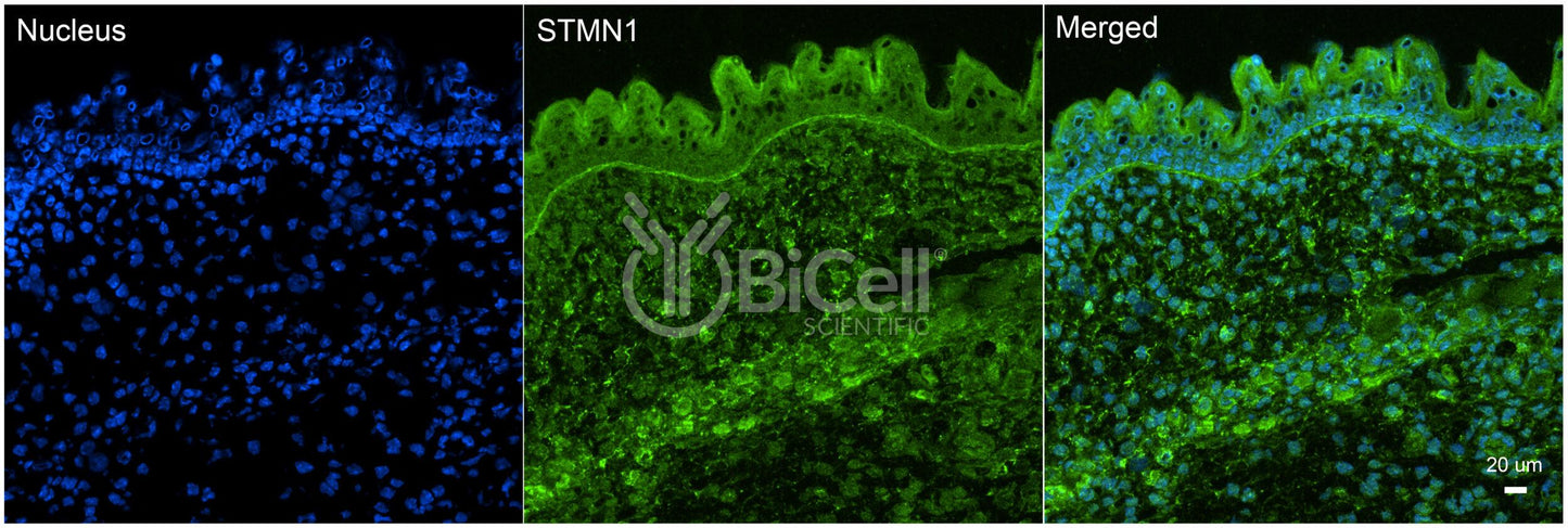 Stathmin (Stathmin-1 or STMN1) Antibody - FFPE Validated