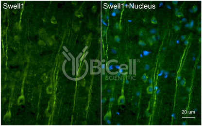 SWELL1 (LRRC8A) Antibody - FFPE Validated